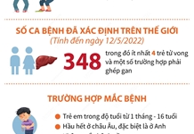 Xung quanh bệnh viêm gan bí ẩn ở trẻ em