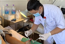 Bệnh viện Đa khoa tỉnh: Nối thành công 3 ngón tay bị đứt lìa